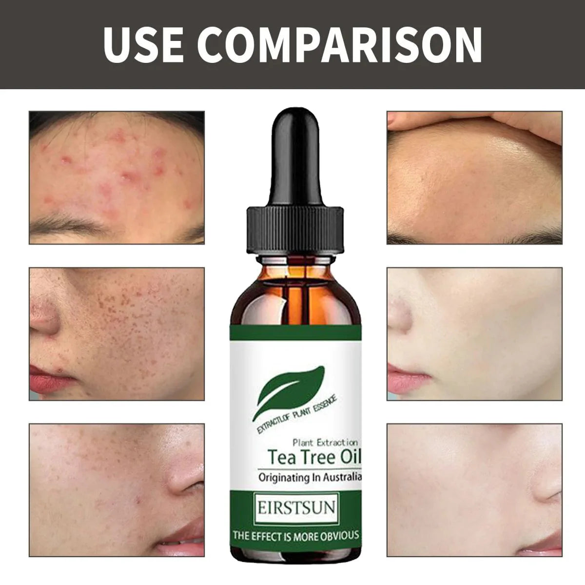 Natural Tea Tree Oil Moisturizer Face Body Skin Care for Women Hair Care