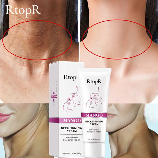 RtopR Neck Firming Wrinkle Remover Cream Rejuvenation Firming Skin Whitening